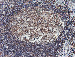 LIMK1 Antibody in Immunohistochemistry (Paraffin) (IHC (P))