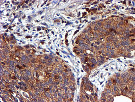 LIMK1 Antibody in Immunohistochemistry (Paraffin) (IHC (P))