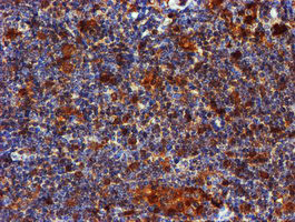 LIMK1 Antibody in Immunohistochemistry (Paraffin) (IHC (P))