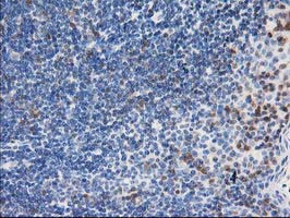 LIMK1 Antibody in Immunohistochemistry (Paraffin) (IHC (P))