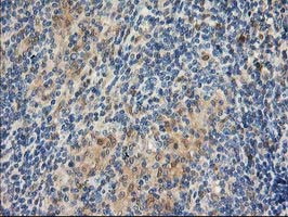 LIMK1 Antibody in Immunohistochemistry (Paraffin) (IHC (P))