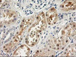 LIMK1 Antibody in Immunohistochemistry (Paraffin) (IHC (P))