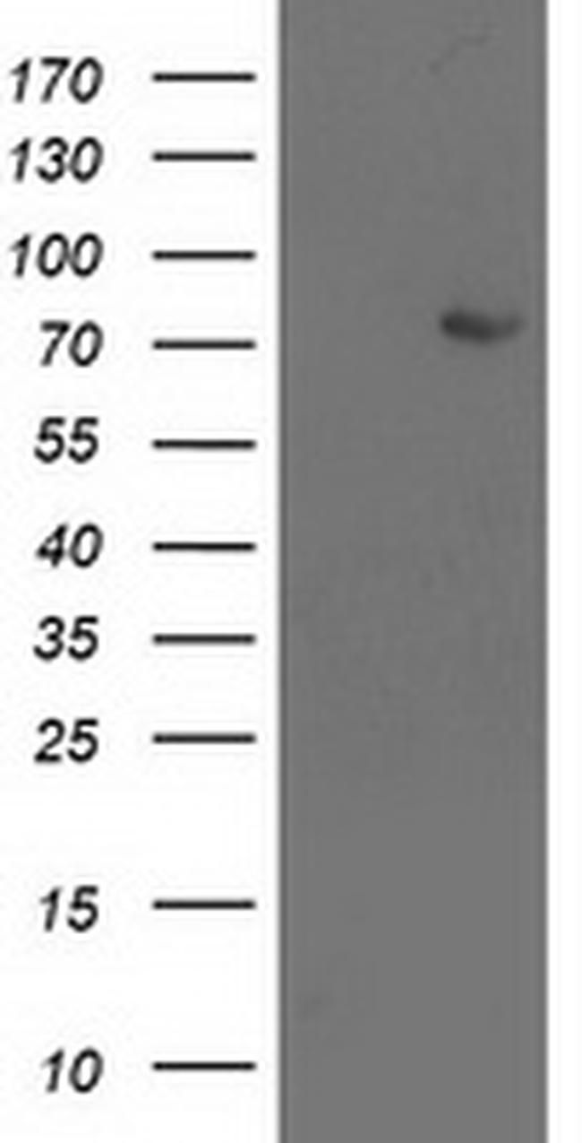 LIMK1 Antibody in Western Blot (WB)