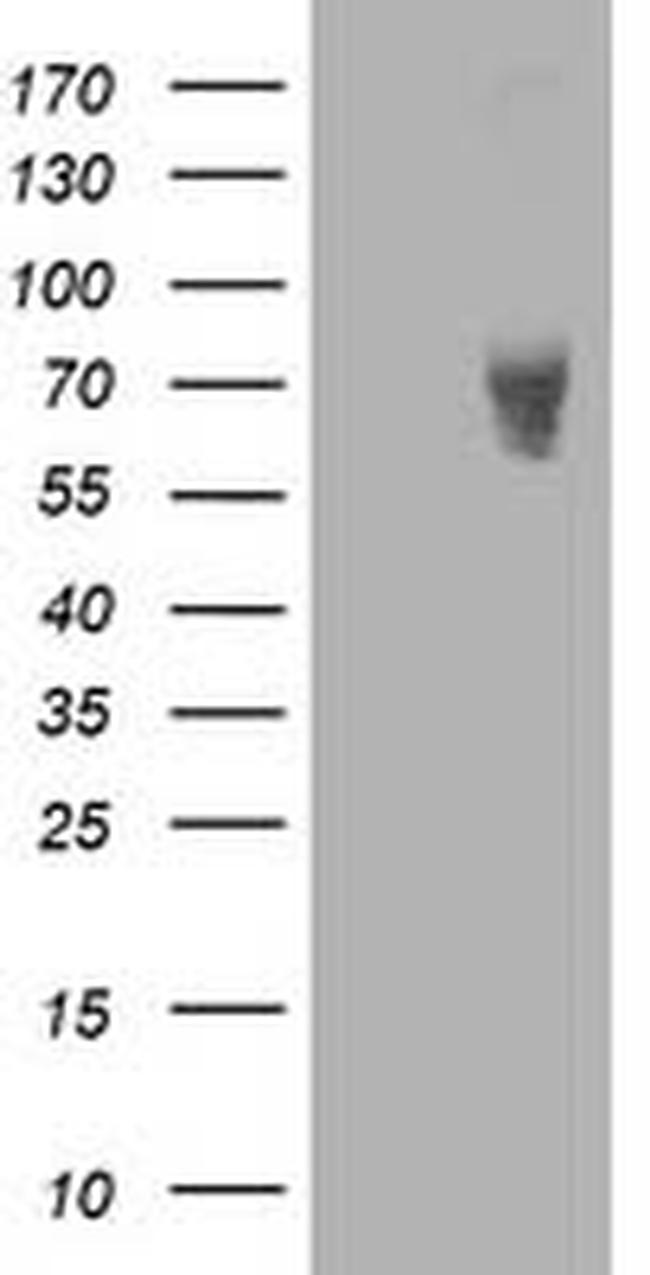 LIMK1 Antibody in Western Blot (WB)