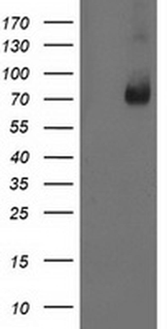 LIMK1 Antibody in Western Blot (WB)