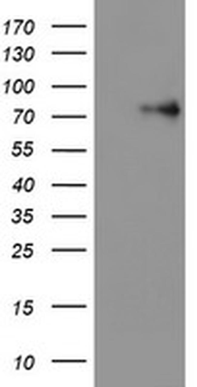 LIMK1 Antibody in Western Blot (WB)