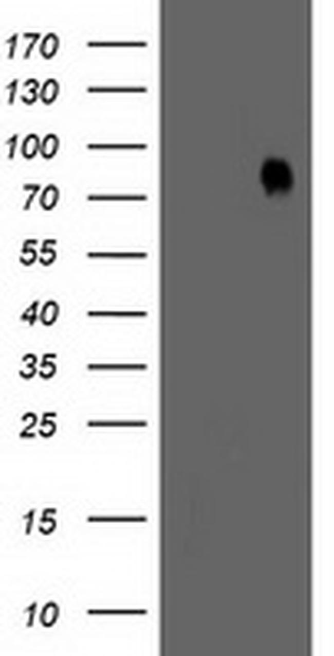 LIMK1 Antibody in Western Blot (WB)