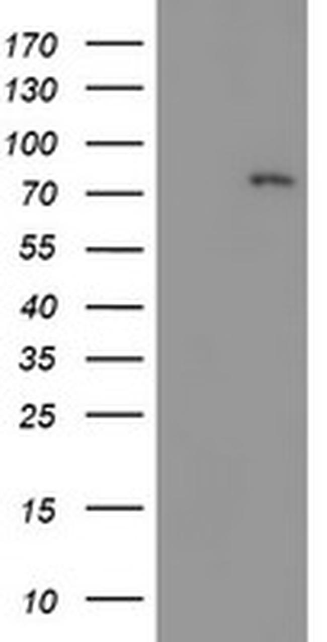 LIMK1 Antibody in Western Blot (WB)