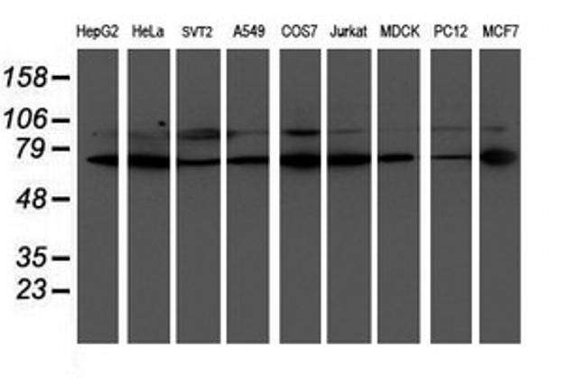 LIMK1 Antibody in Western Blot (WB)