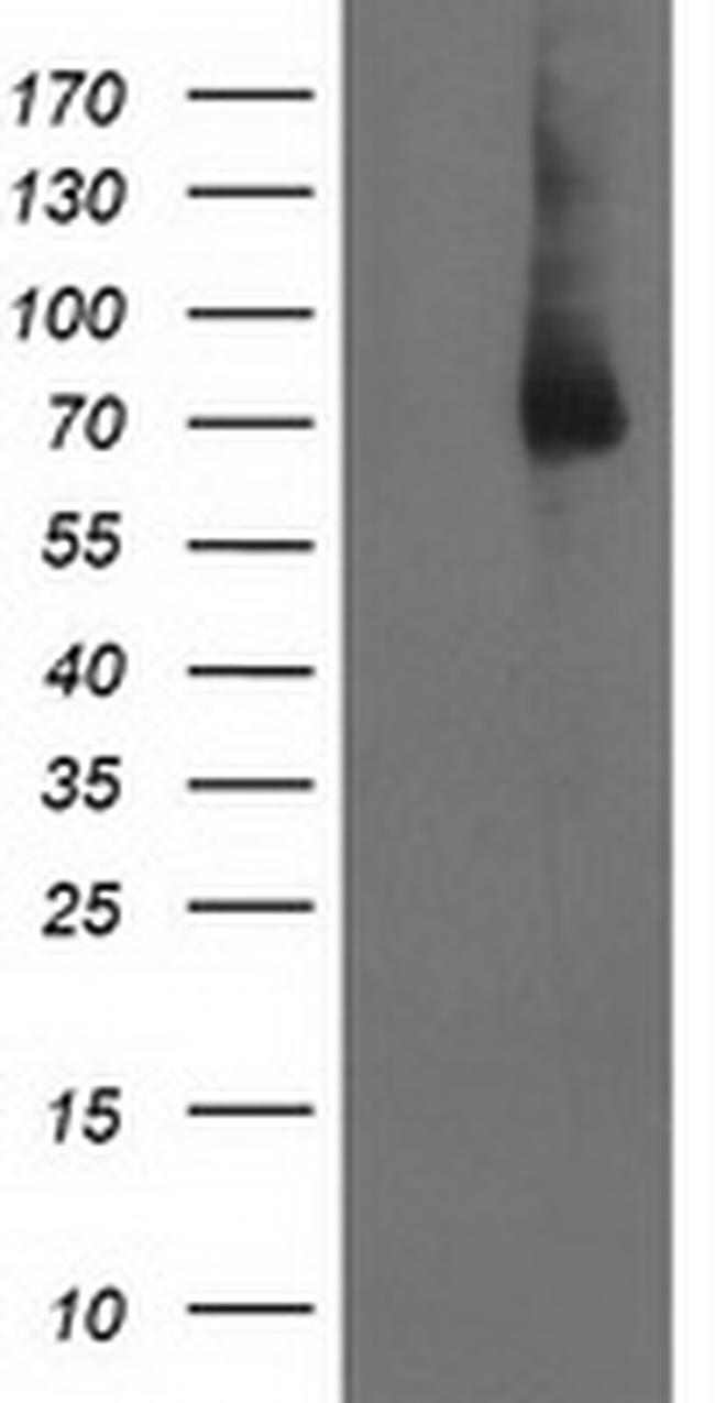 LIMK1 Antibody in Western Blot (WB)