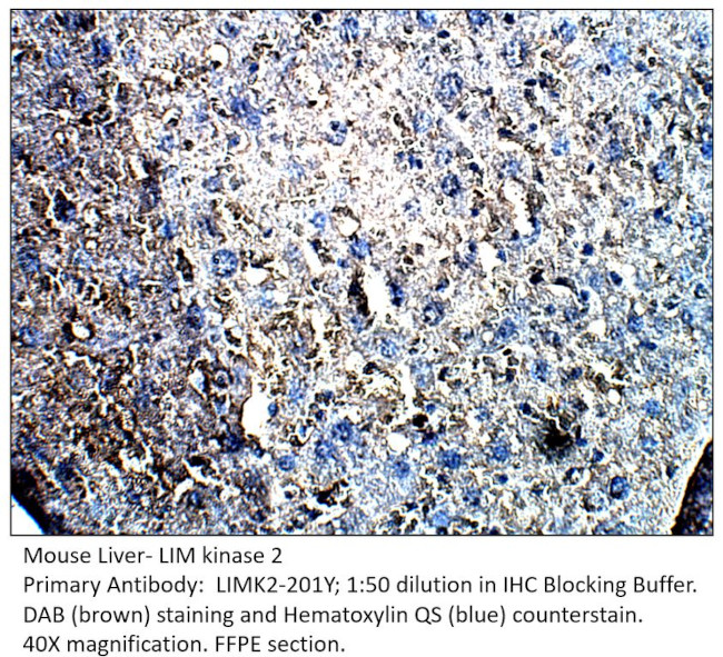 LIM kinase 2 Antibody in Immunohistochemistry (IHC)