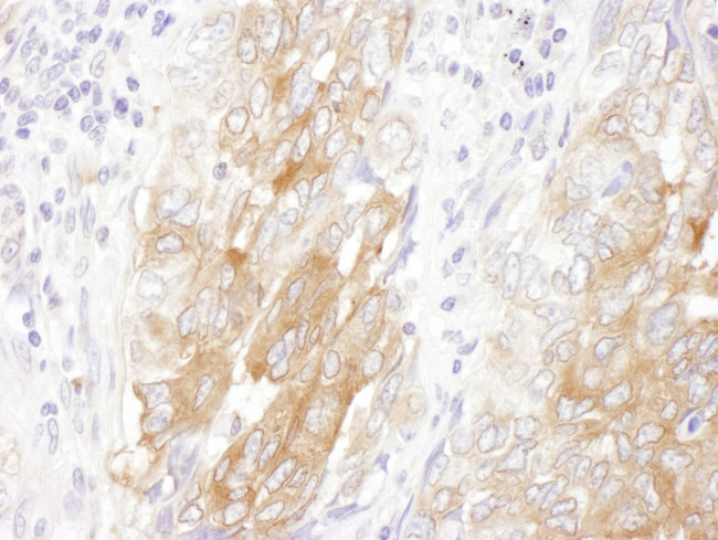 LIN28B Antibody in Immunohistochemistry (IHC)