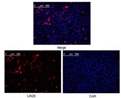 LIN28A Antibody in Immunocytochemistry (ICC/IF)