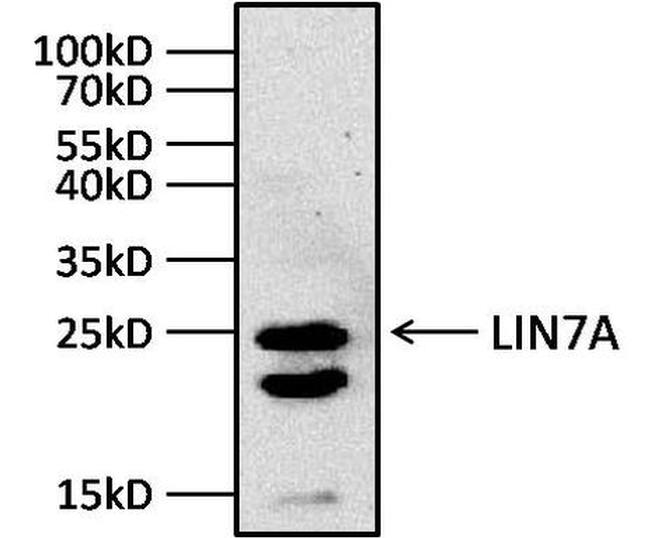 LIN7A Antibody in Western Blot (WB)