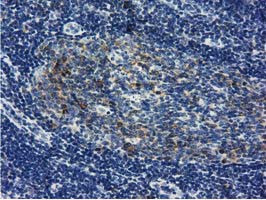 LIN7B Antibody in Immunohistochemistry (Paraffin) (IHC (P))