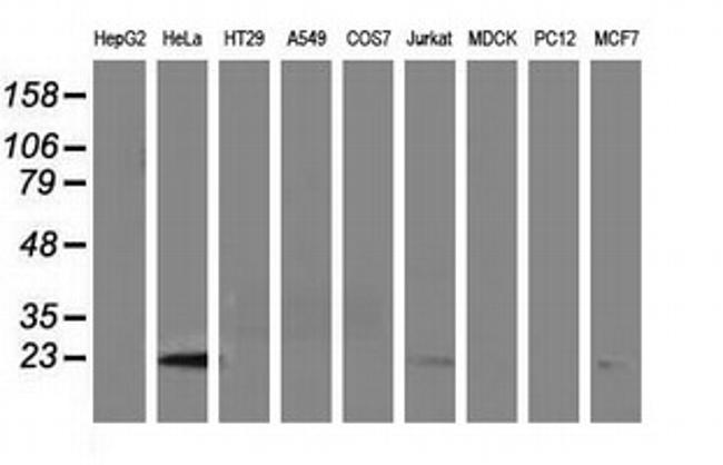 LIN7B Antibody in Western Blot (WB)