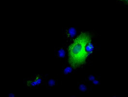 LIPG Antibody in Immunocytochemistry (ICC/IF)