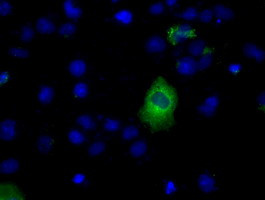 LIPG Antibody in Immunocytochemistry (ICC/IF)