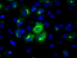 LIPG Antibody in Immunocytochemistry (ICC/IF)