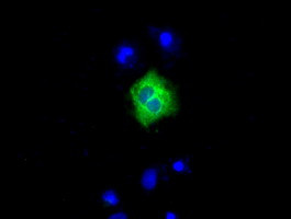 LIPG Antibody in Immunocytochemistry (ICC/IF)