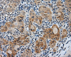 LIPG Antibody in Immunohistochemistry (Paraffin) (IHC (P))