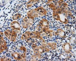 LIPG Antibody in Immunohistochemistry (Paraffin) (IHC (P))