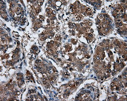 LIPG Antibody in Immunohistochemistry (Paraffin) (IHC (P))