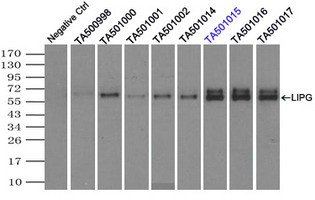 LIPG Antibody in Immunoprecipitation (IP)