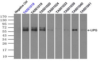 LIPG Antibody in Immunoprecipitation (IP)