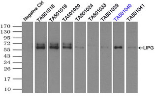 LIPG Antibody in Immunoprecipitation (IP)