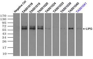 LIPG Antibody in Immunoprecipitation (IP)