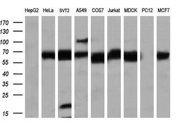 LIPG Antibody in Western Blot (WB)