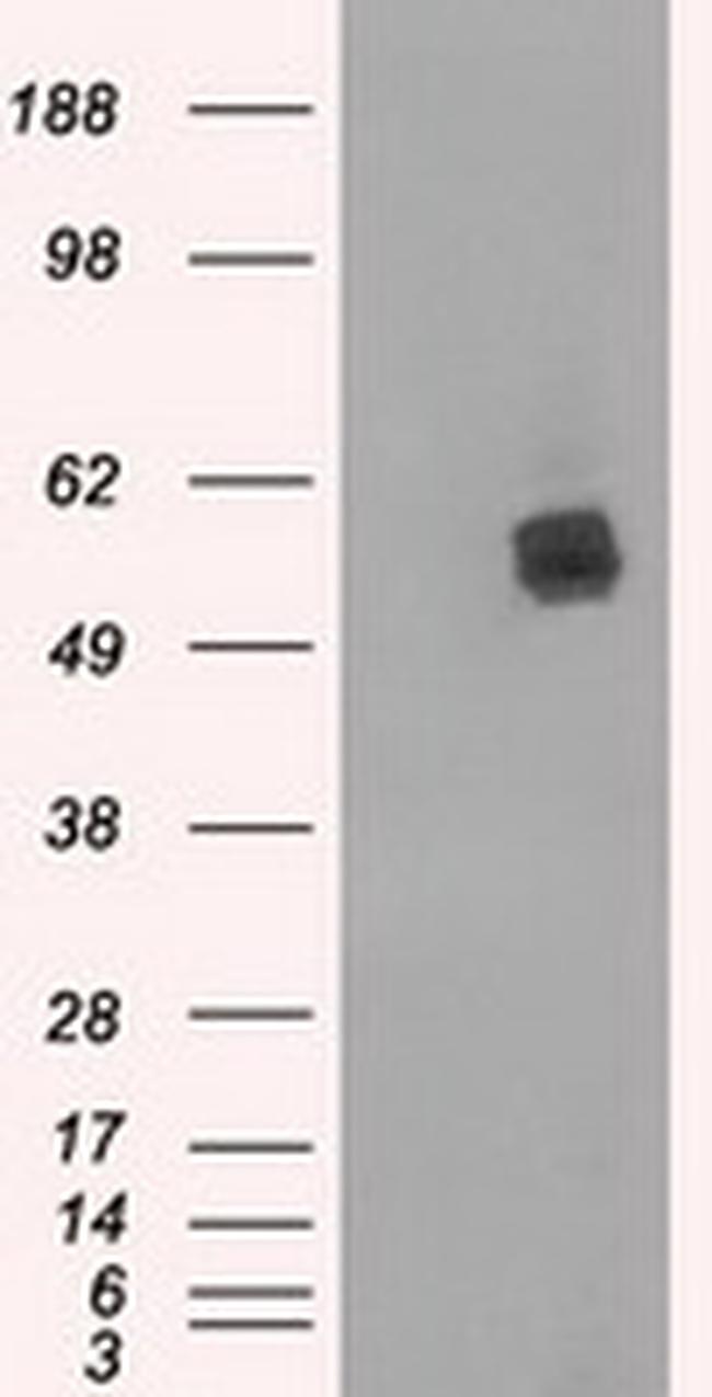 LIPG Antibody in Western Blot (WB)