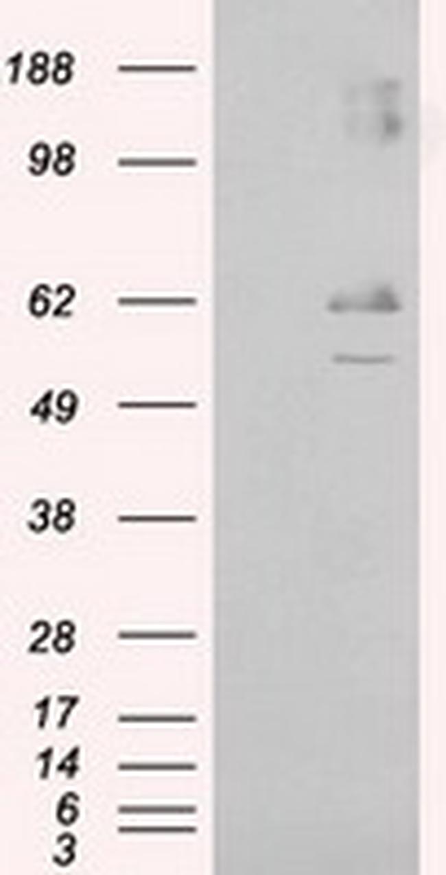 LIPG Antibody in Western Blot (WB)