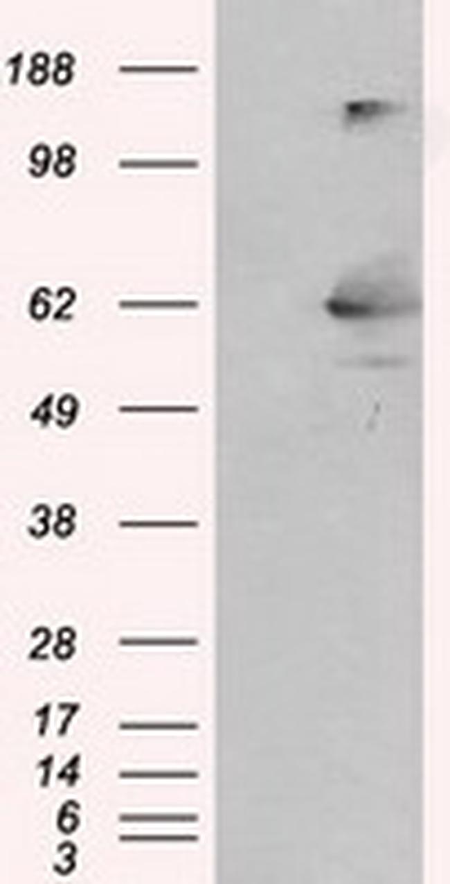 LIPG Antibody in Western Blot (WB)