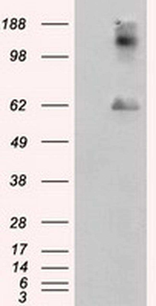 LIPG Antibody in Western Blot (WB)