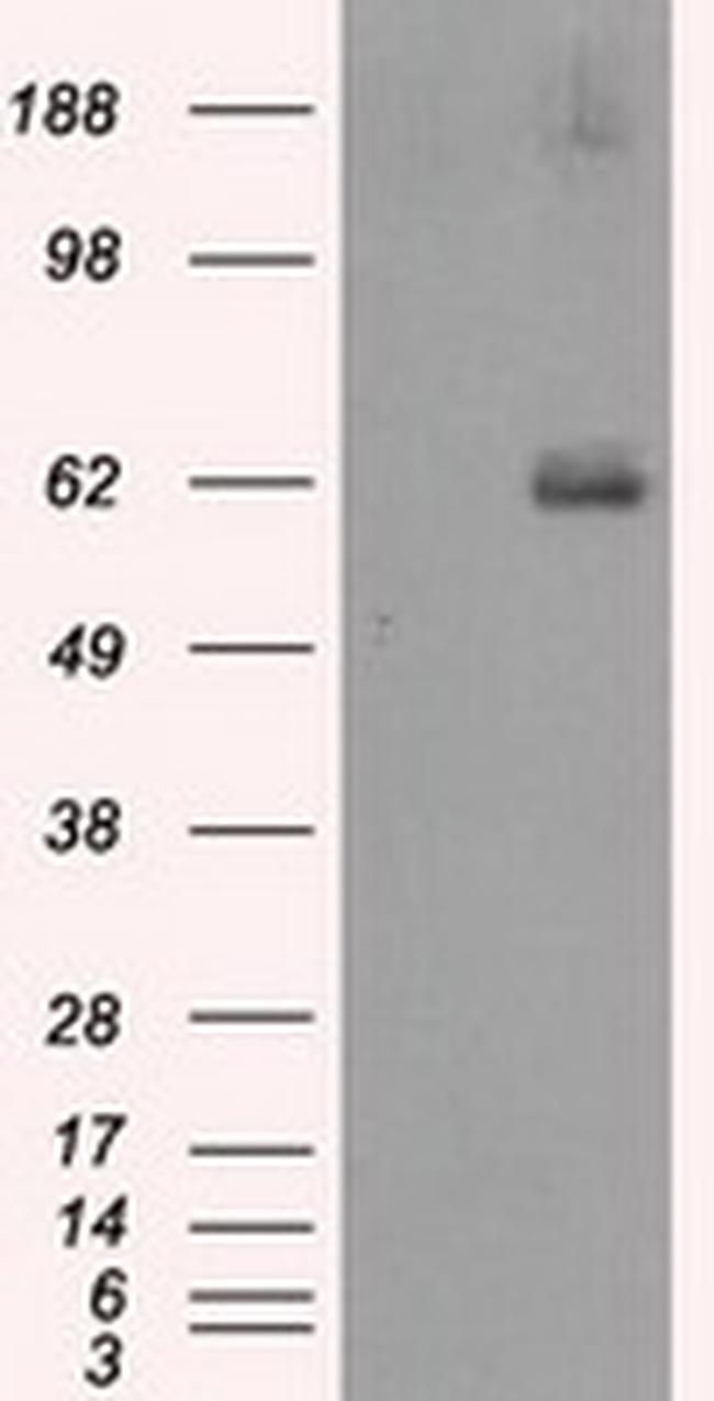 LIPG Antibody in Western Blot (WB)