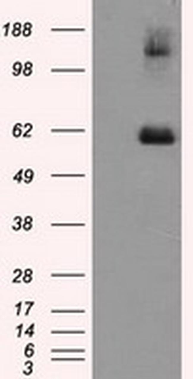 LIPG Antibody in Western Blot (WB)