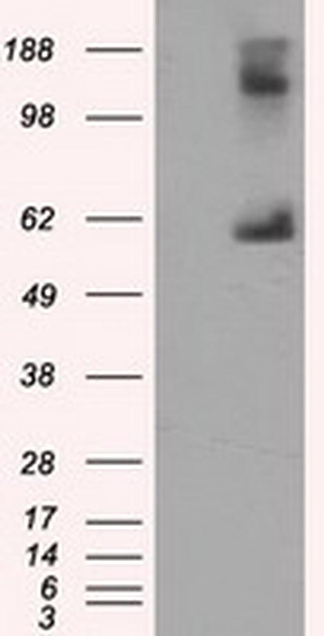 LIPG Antibody in Western Blot (WB)