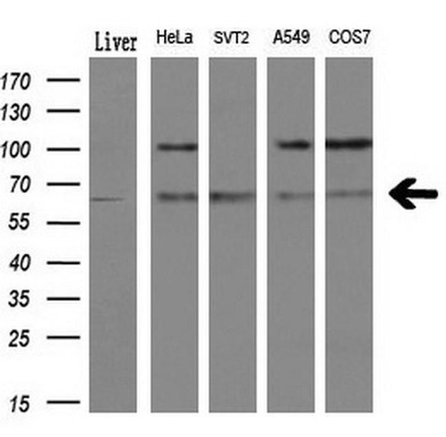 LIPG Antibody in Western Blot (WB)