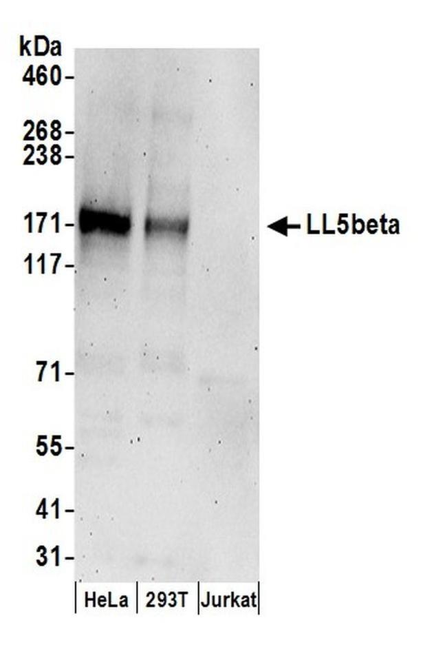 LL5beta Antibody in Western Blot (WB)