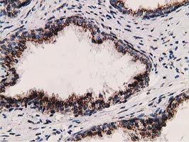 LMAN1 Antibody in Immunohistochemistry (Paraffin) (IHC (P))