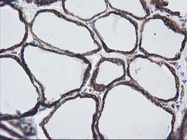 LMAN1 Antibody in Immunohistochemistry (Paraffin) (IHC (P))