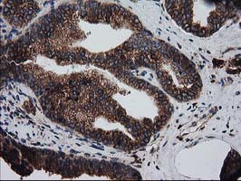 LMAN1 Antibody in Immunohistochemistry (Paraffin) (IHC (P))