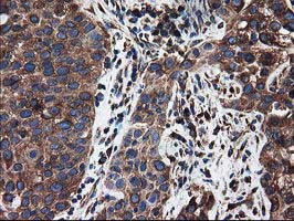 LMAN1 Antibody in Immunohistochemistry (Paraffin) (IHC (P))