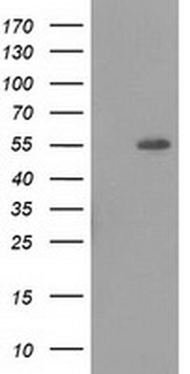 LMAN1 Antibody in Western Blot (WB)