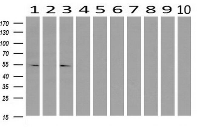 LMAN1 Antibody in Western Blot (WB)