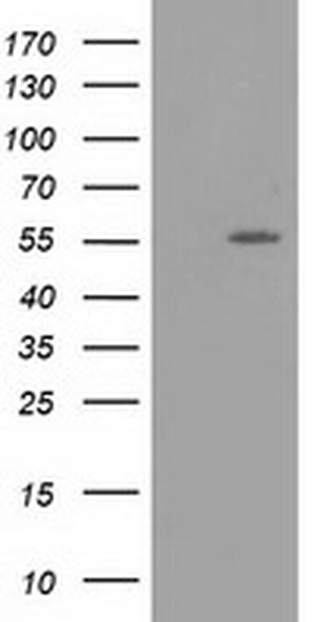 LMAN1 Antibody in Western Blot (WB)