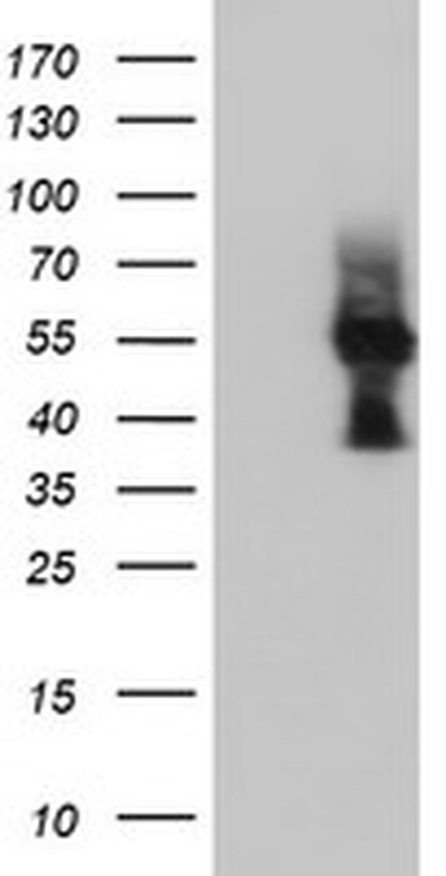 LMAN1 Antibody in Western Blot (WB)