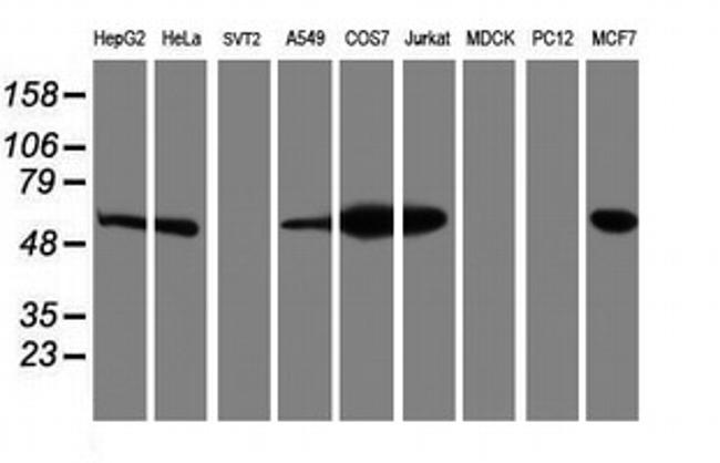 LMAN1 Antibody in Western Blot (WB)